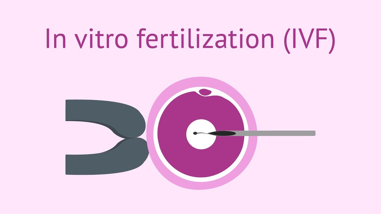 Fecundación in vitro barcelona